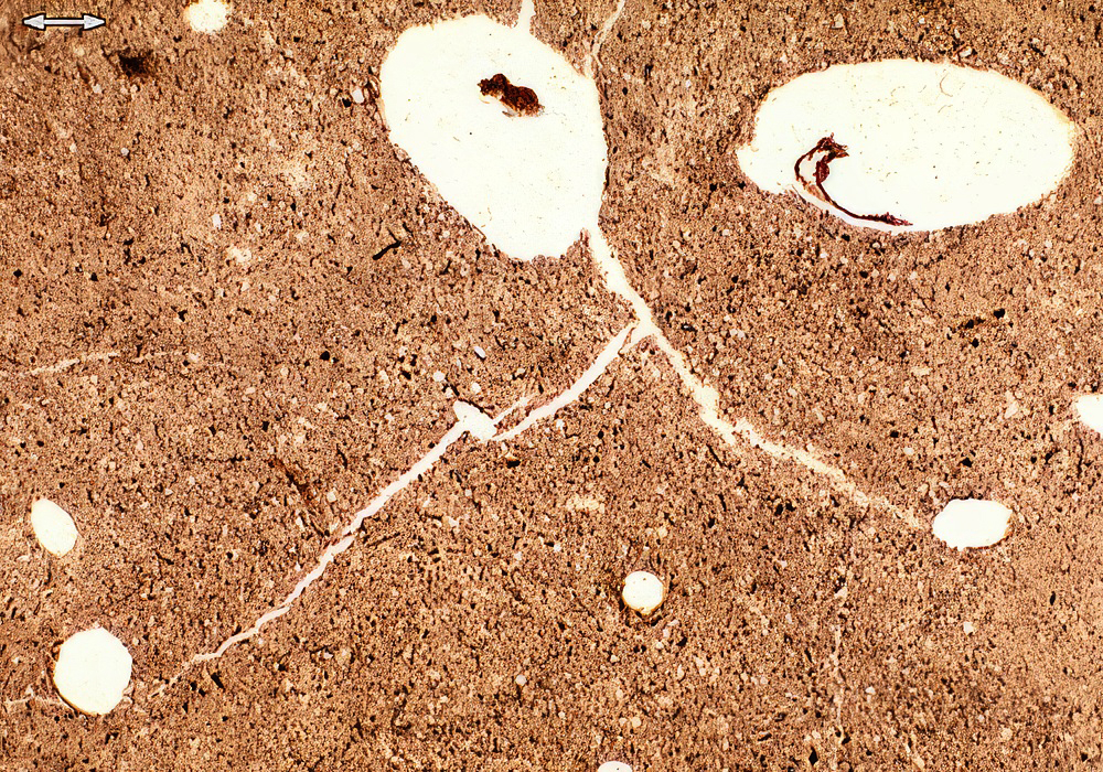 grava1